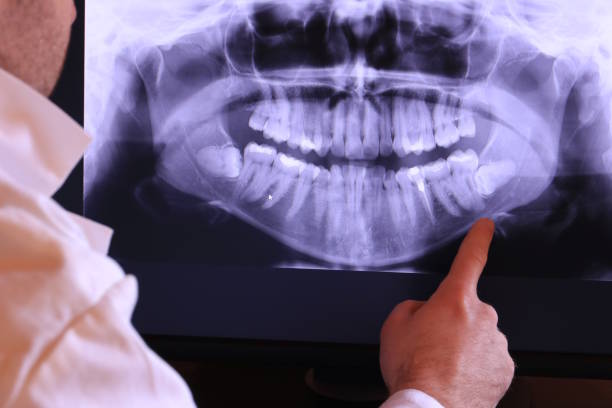 Best Emergency Dental Care for Trauma or Injury in Webster, FL
